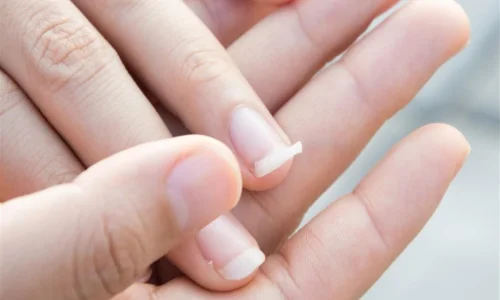 ما هي اسباب تكسر الاظافر؟