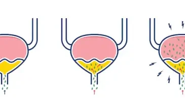 علاج التهاب البول تجربتي