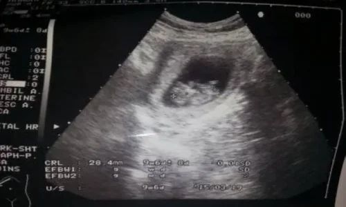 متى يبان جنس الجنين؟