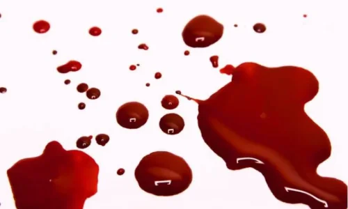 ما تأويلات رؤية الدم في اليد في المنام للعزباء؟