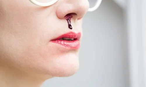 ما تأويلات ابن سيرين لرؤية الرعاف في المنام للعزباء؟