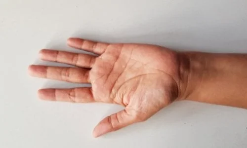 تعرف على أهم 50 دلالة لرؤية اليد المبتورة في المنام