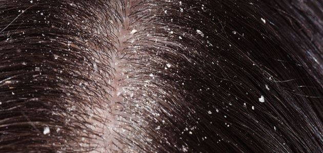 أهم تفسيرات رؤية القشرة في المنام لابن سيرين