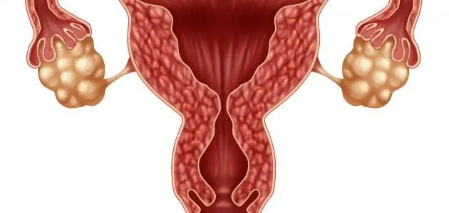الرحم في المنام